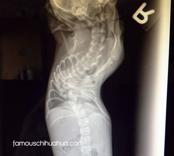 xray of max's spine!