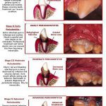 four stages periodontal disease dogs